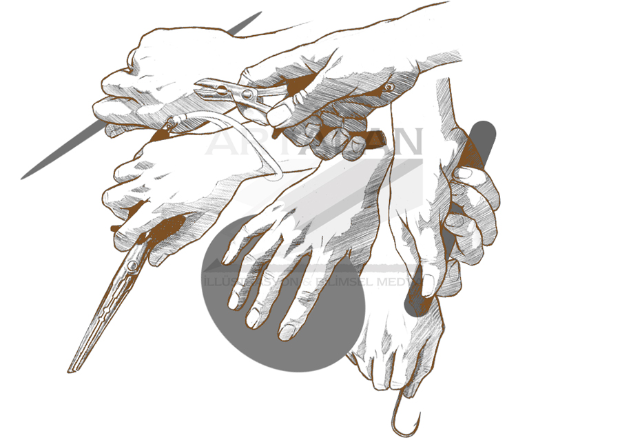 illstrasyon Bahadr apar | www.artalan.net